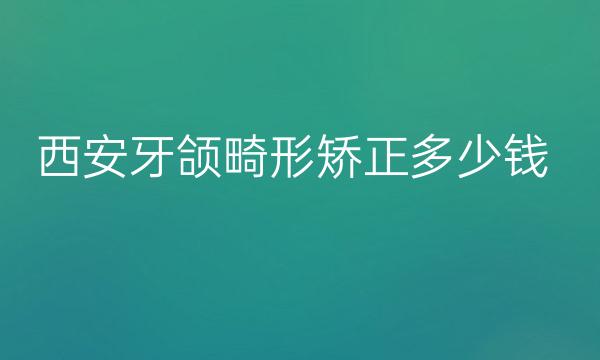 西安牙颌畸形矫正整形医院哪家好?医院排名了解