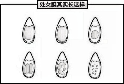 处女膜修复多少钱 合肥私密整形哪家医院好