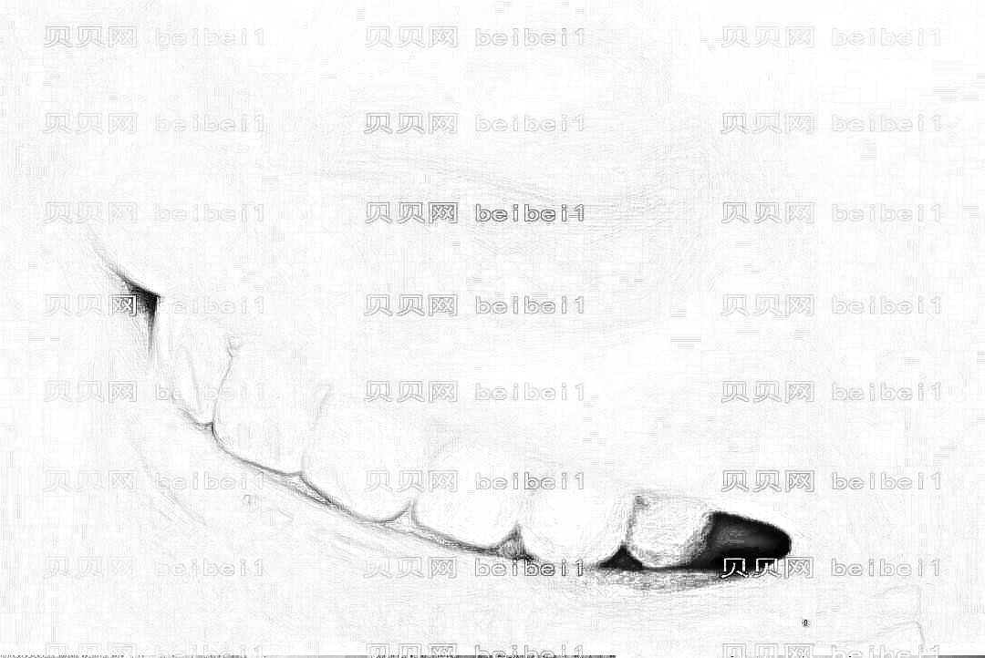 西安艺星医疗美容医院陈杰医师洗牙洁牙介绍片较新分享_我的牙齿很整齐很白了吧