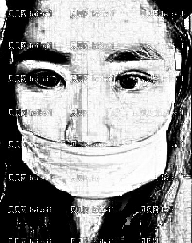 西安西美整形外科中心王艳娜双眼皮整形介绍片较新分享_2个月眼睛就恢复了果很自然滴咯！