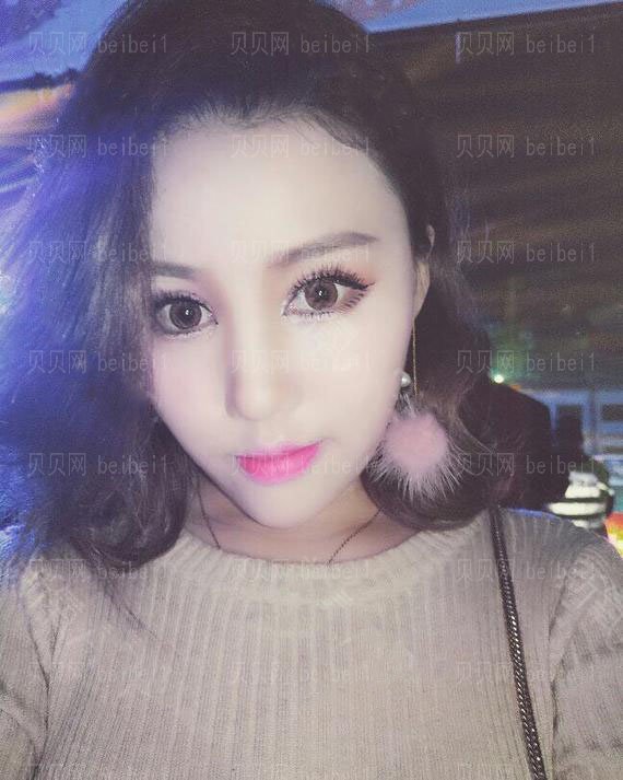 西京医院整形科彭湃切开双眼皮介绍片较新分享_眼睛恢复得毫无违和感了咯！