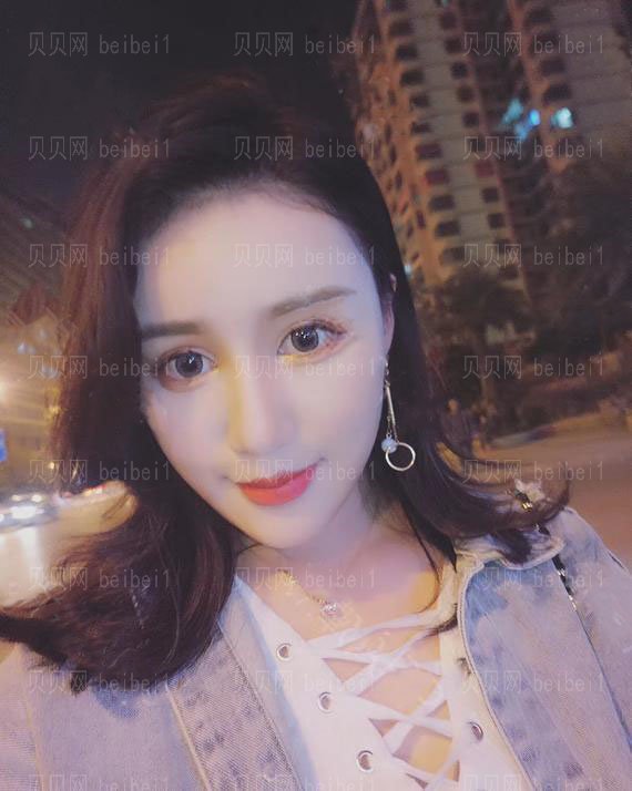 西京医院整形科彭湃切开双眼皮介绍片较新分享_眼睛恢复得毫无违和感了咯！