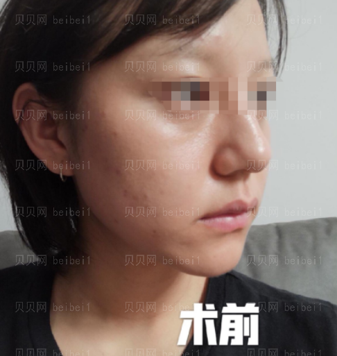 西京医院整形科樊星水光美肤介绍片较新分享_经过这次皮肤调节，我也有了更大的信心了哦。