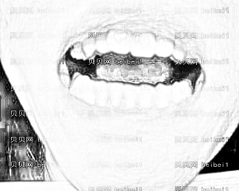 太原华美整形美容医院白丽鹏超声波洁牙介绍片较新分享_超声波洁牙，让自己的牙齿更健康。
