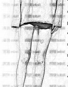 天津美莱医学美容医院王志军大腿吸脂介绍片较新分享_好身材就是这么简单！