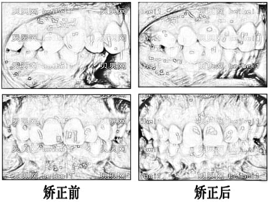 成都新桥口腔怎么样？,正畸曝光！哪个医生技术好