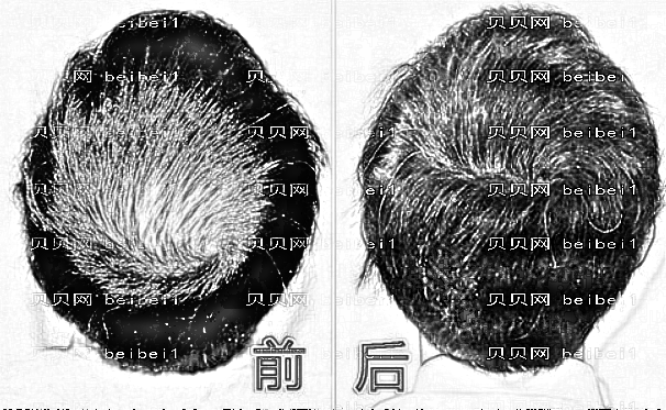 成都雍禾植发怎么样？哪个医生技术好