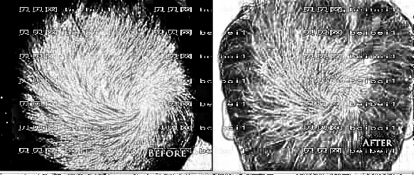 成都雍禾植发怎么样？哪个医生技术好