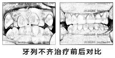 兰州皓亚口腔医院怎么样？哪个医生技术好