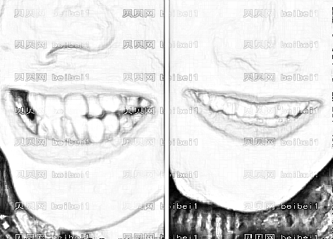 深圳尔睦口腔医院怎么样？,正畸价格一览表！医生排名名单