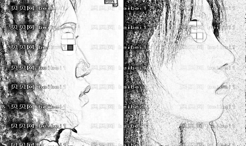 昆山米扬丽格隆鼻怎么样？昆山米扬丽格隆鼻医生名单+整形