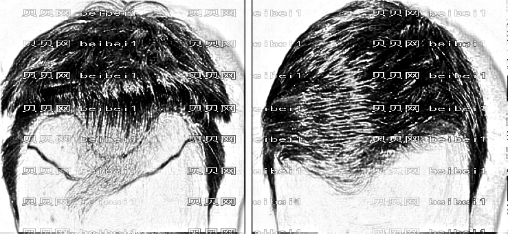 西安植发哪家医院好？多少钱？附西安植发医生排名名单