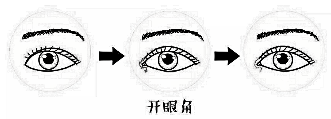 眼角开大了怎么办？可以修复吗？