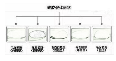 你知道你的隆胸植入物吗？有关假体隆胸乳房植入物的分类！