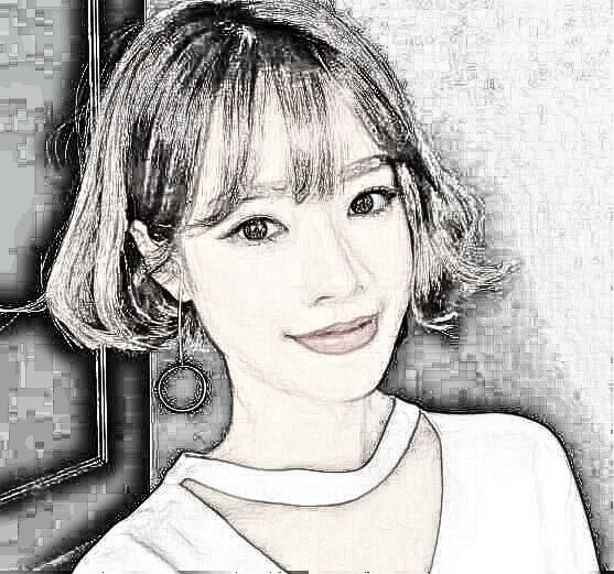注射瘦脸手术后大变活力美少女