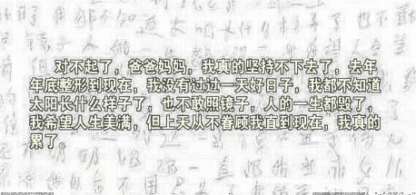 女孩小贺留遗书自杀背后的原因 整形失败无法面对