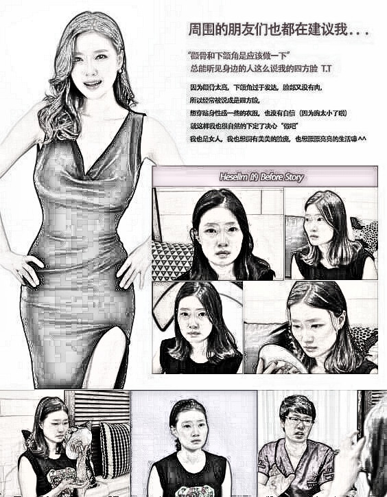 全脸改造+隆胸是什么样的？