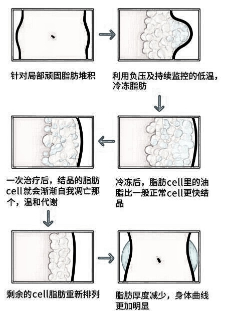 冷冻溶脂瘦大腿果，惊呆你！