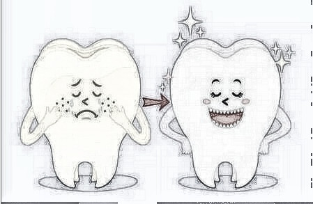 四环素牙如何美白——牙齿变黑，可不一定是蛀牙惹的祸！