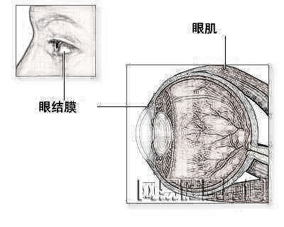 提肌恢复期出现不对称怎么办?