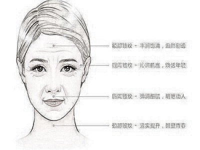 除皱什么微整方法好