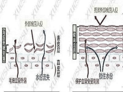 怎样祛除红血丝保养肌肤呢