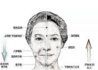 除皱紧致肌肤那种方法好 拉皮美容价格贵不贵