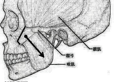 下颌角肥大矫正术的果