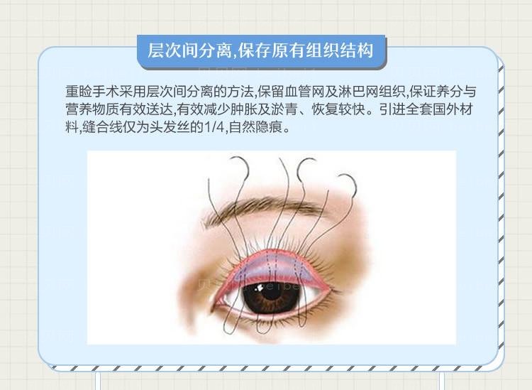 鹿世江双眼皮怎么样