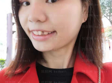 上海华美医疗美容医院黄嵩—隐形牙齿矫正介绍