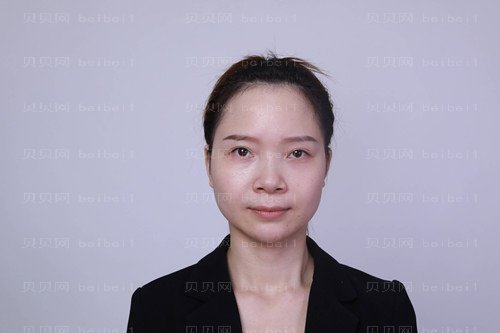 上海诗诺雅医疗美容医院方贻松隆鼻介绍