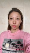上海诗诺雅医疗美容医院杨礼肋软骨隆鼻介绍