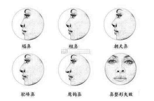 隆鼻失败后呈现的排斥、感染要怎么处理?