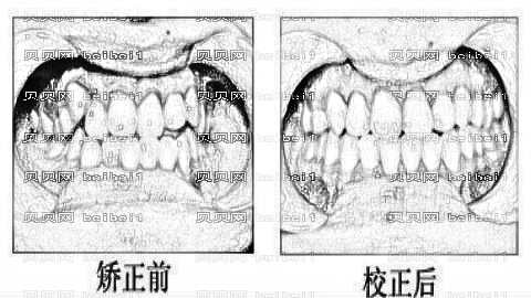 成都圣贝牙科怎么样？,正畸曝光！哪个医生技术好