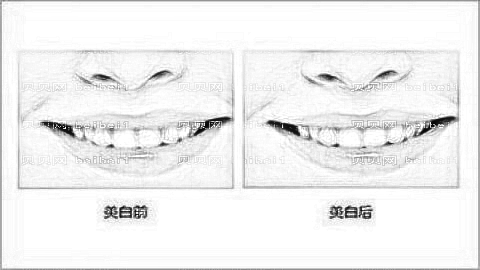 成都格林口腔怎么样？,正畸曝光！哪个医生技术好