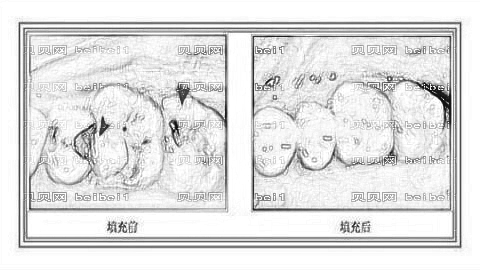 济南济东口腔医院怎么样？哪个医生技术好