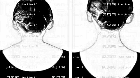 福州达拉斯整形医院怎么样？医生团队+整形价格