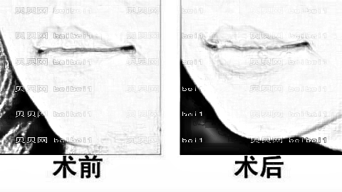 嘉兴曙光整形医院怎么样？医生团队+整形价格