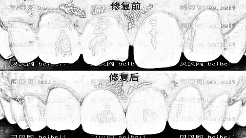 福能海峡口腔医院怎么样？医生排名名单