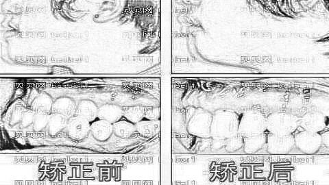 厦门麦芽口腔医院怎么样？医生排名名单