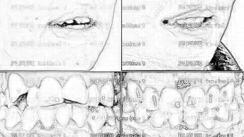 厦门齿度口腔医院怎么样？医生排名名单