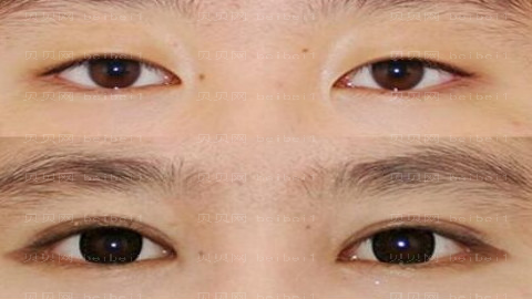 兰州圣莫丽斯整形医院怎么样？医生排名