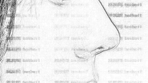 隆鼻手术是切哪里?隆鼻手术需要多久?