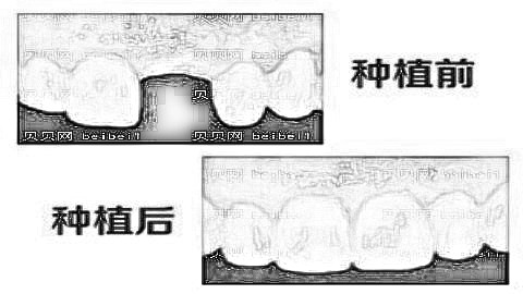 广州穗华口腔口碑怎么样？医生介绍名单