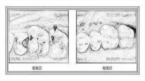 惠城瑞芙臣口腔医院怎么样？医生介绍名单