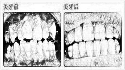 深圳美奥口腔口碑怎么样？内部正畸曝光！医生排名名单