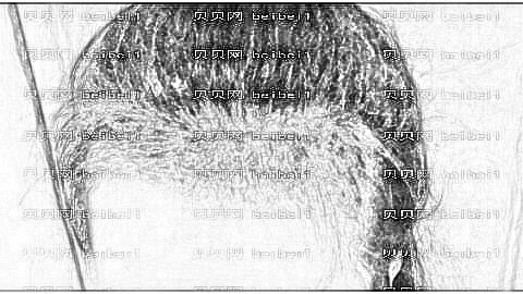 南宁贞韩植发医院靠谱吗？哪个医生发际线植发做得好？附