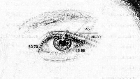 上海时保义做眼睛怎么样?上海时保义做眼睛手术介绍及