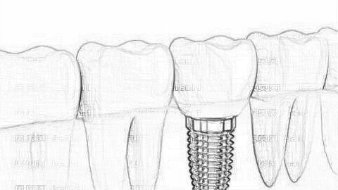 三亚拜博口腔医院种植牙多少钱？附,口腔+医生介绍