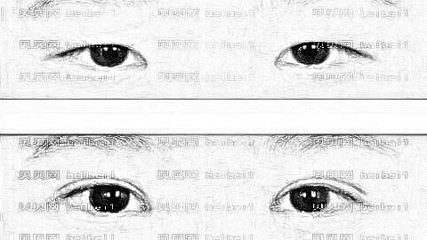 贵阳美和谐整形医院靠谱吗？贵阳美和谐双眼皮多少钱？附